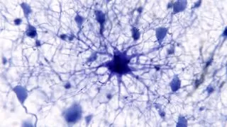 Microscope image showing a star-shaped astrocyte brain cell with extensions connecting to other cells, highlighting its complex structure and potential role in memory.